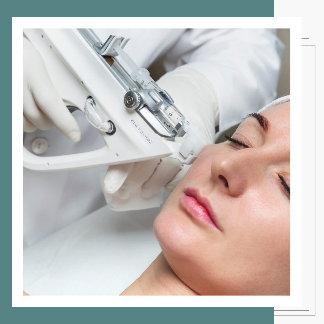 Radiofrequency facial treatment